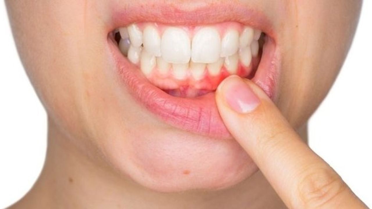 Diş neden ağrır? Diş ağrısının sebepleri nelerdir?