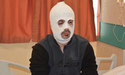 Erzurum'da piknik tüpünün alev almasıyla yüzü yanan tır şoförünün tedavisi sürüyor