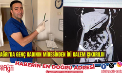 Ağrı’da kadının midesinden iki kalem çıkarıldı