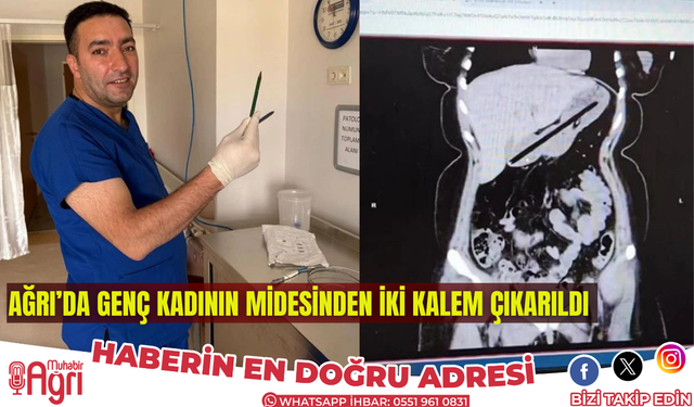 Ağrı’da kadının midesinden iki kalem çıkarıldı