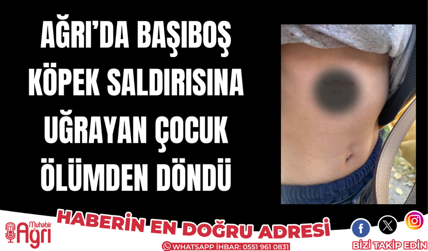 Ağrı’da köpek saldırısına uğrayan çocuk ölümden döndü