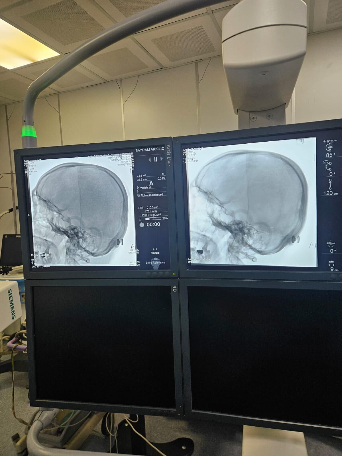 G5 Z F R Sr W8 A Aqup Y